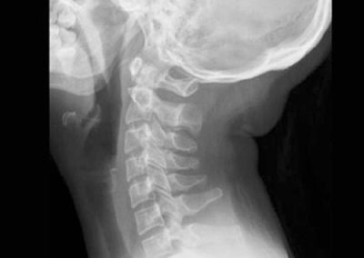 radiografias