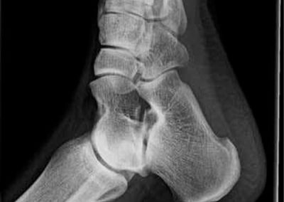 radiografias