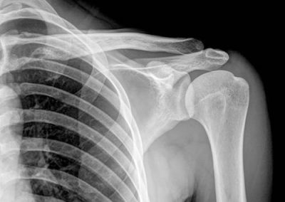 radiografias