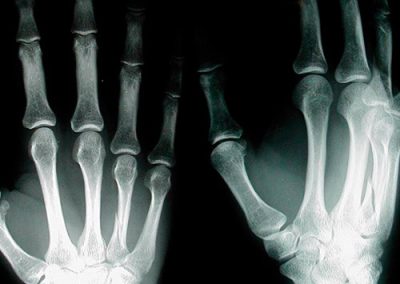 radiografias