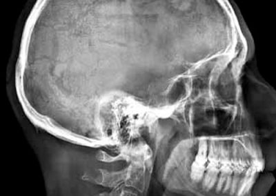 radiografias