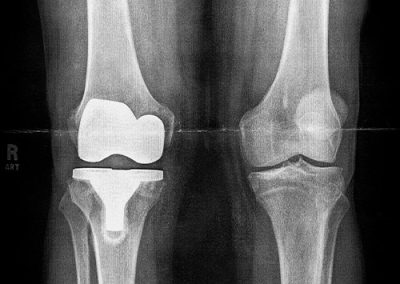 radiografias
