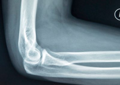 radiografias