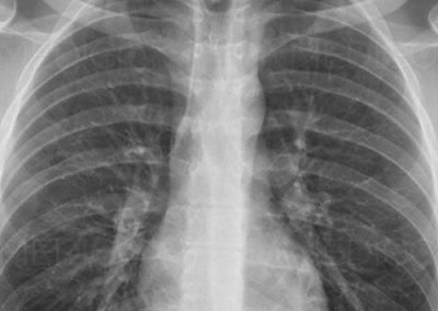 radiografias